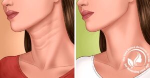 بررسی وضعیت و عمق چروکهای روی گردن